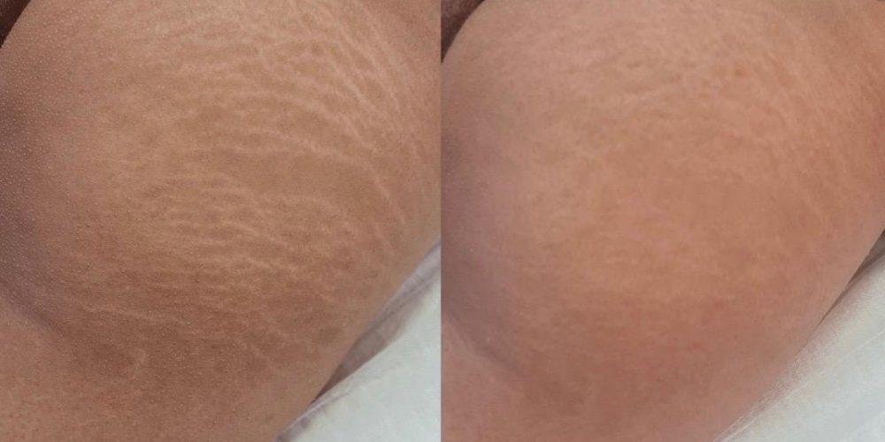 WhatsApp Image 2025-11-06 at 09.30.53 (1)