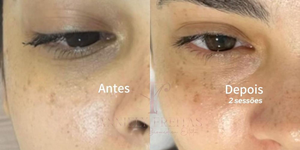 WhatsApp Image 2025-11-06 at 09.33.08